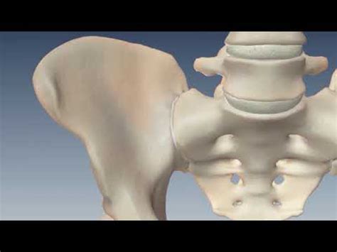 Sacroiliac Joint Fusion With The Ifuse Implant System Youtube