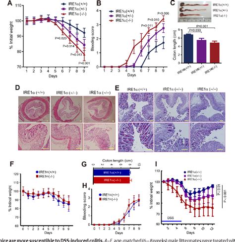 Figure 5 from The Endoplasmic Reticulum Stress Sensor IRE1α in