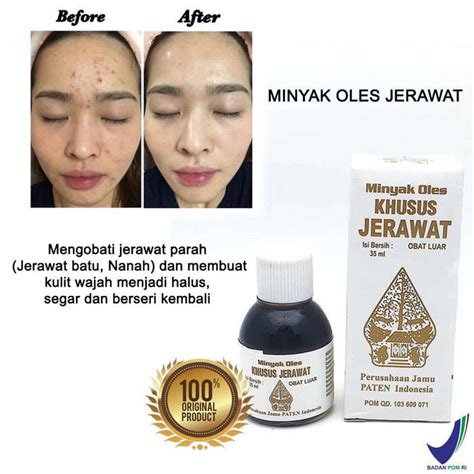 Minyak Oles Serum Jerawat Cap Wayang Original Lazada Indonesia