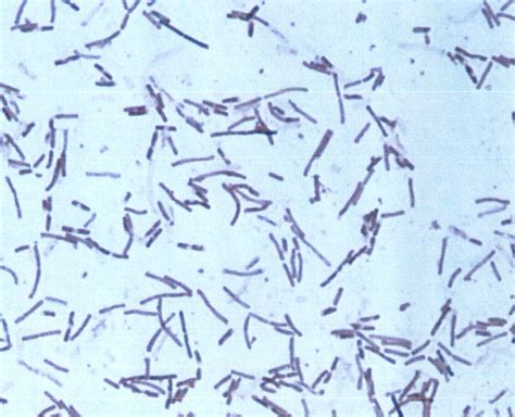 Sacrifices For The Love Of Science Bacillus Subtilis