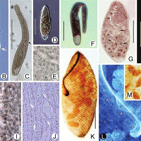 Photomicrographs Of Spirostomum Minus From Life A G I J After Dapi