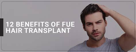 12 Benefits Of Fue Hair Transplant