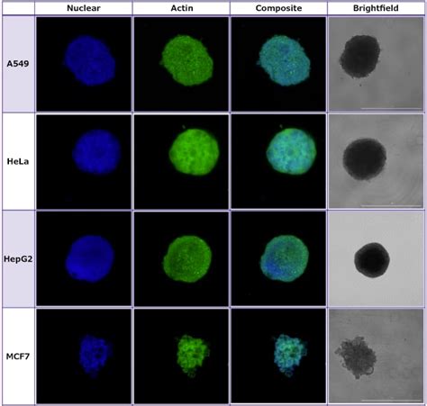 Evaluation Of Spheroid Formation And Robustness Using Millicell Ultra