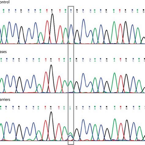 Sequence Traces From Exon 2 Of The Tpo Gene Showing The Mutation Y55x