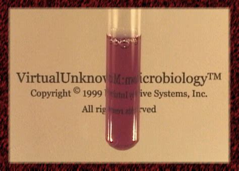 Lysine decarboxylase test - Virtual Microbiology Lab Simulator Software