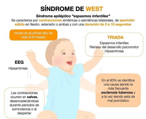 O Que Síndrome De West - Sahum alerta sobre el síndrome de West: Una rara epilepsia que afecta a ...