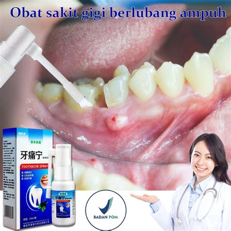 Jual Obat Sakit Gigi Semprot Semprotan Pereda Nyeri Obat Sakit Gigi