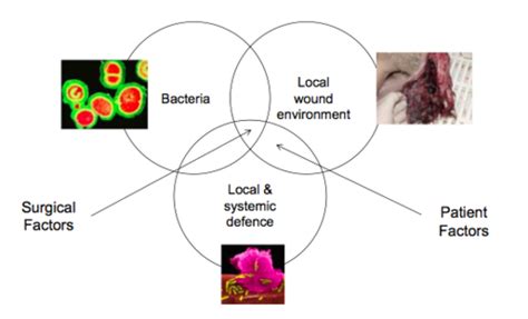 Aseptic technique Flashcards | Quizlet 