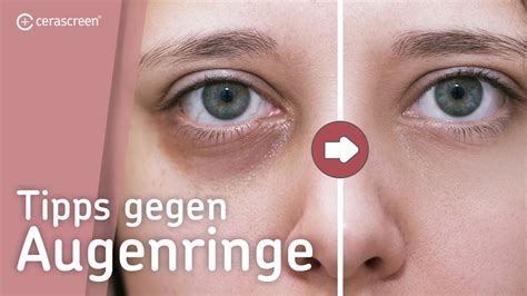 Tipps Gegen Augenringe Ursachen Eines Eisenmangels Youtube