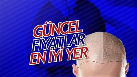 Türkiyenin En İyi Saç Ekim Merkezi 2024 Fiyatları Sağlık