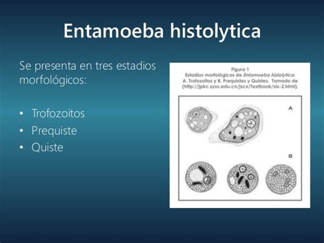 Absceso Hepático Amebiano