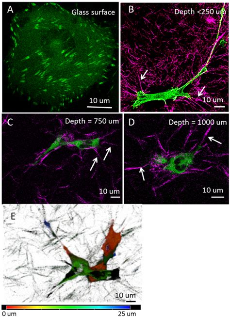 MDA MB 231 Cells In 3D Type I Collagen Matrix AD 2 Photon