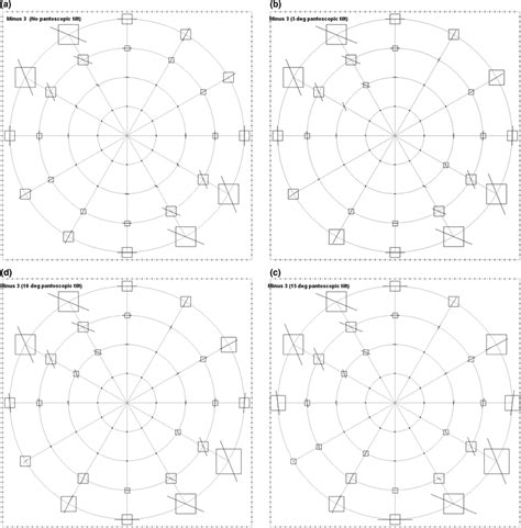 Pantoscopic Tilt In Spectacle‐corrected Myopia And Its Effect On