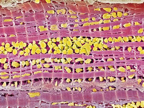 Cardiac Muscle Sem Stock Image P Science Photo Library