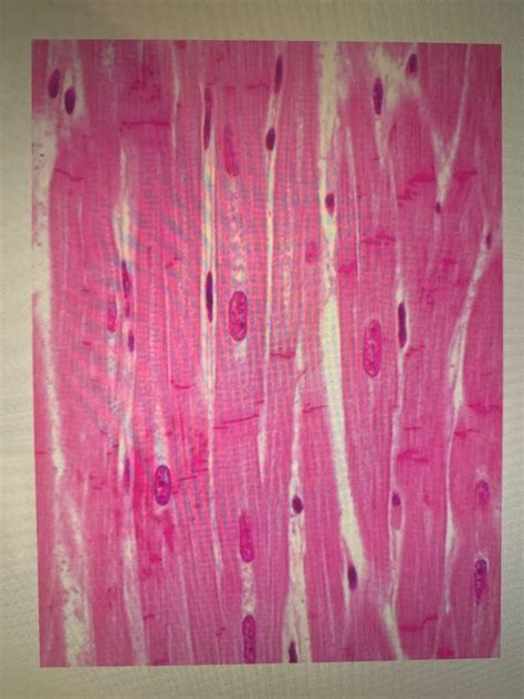 Cardiac Muscle Slide