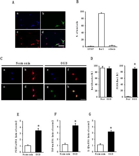 Ijms Free Full Text Involvement Of Progranulin And Granulin