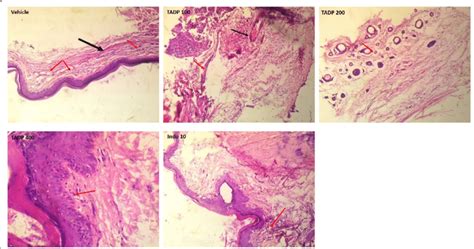 Photomicrograph Of Histopathologic Examination Of Paw Tissue Of Rats