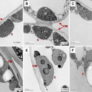 Transmission Electron Micrographs Of Transverse Sections From Cell