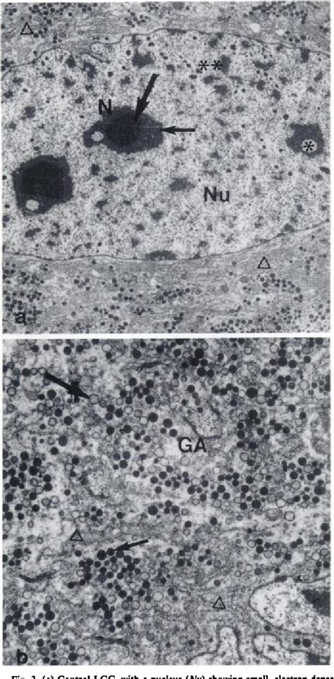 Figure 1 From Quantitative Ultrastructural Effects Of Cisplatin