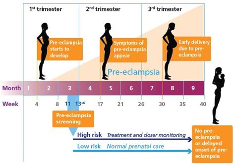 Pre Eclampsia What Women Should Aware Of Dr Iman Firmansyah