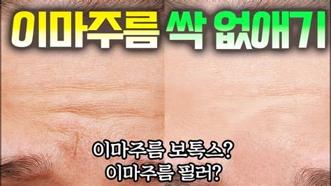 열 배 더 나이들어 보이게 하는 이마주름 없애기ㅣ이마보톡스 Vs 이마필러 Youtube