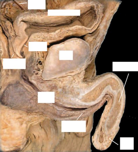 LAB Reproductive System Pic 4 Diagram Quizlet