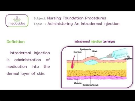 57.Administering An Intradermal Injection - YouTube