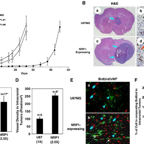 Overexpression Of Nrp1 In U87mg Cells Promotes Tumor Growth And