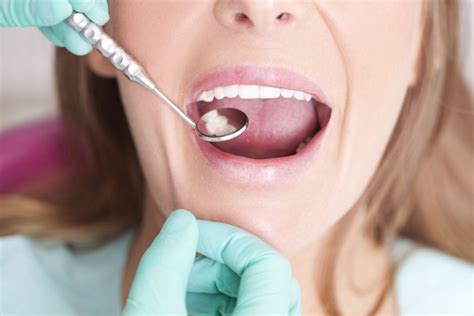 Everything One Should Know About Gum Grafting