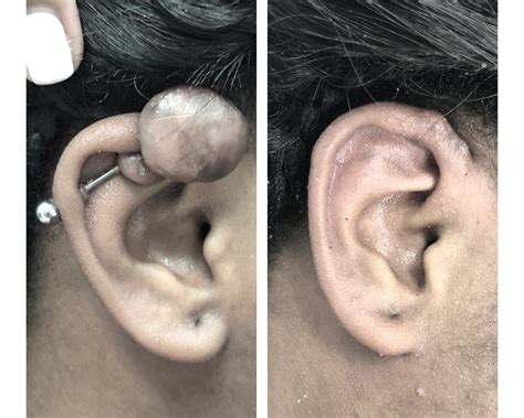 Ear Surgery Transformations — DR JOE DUSSELDORP