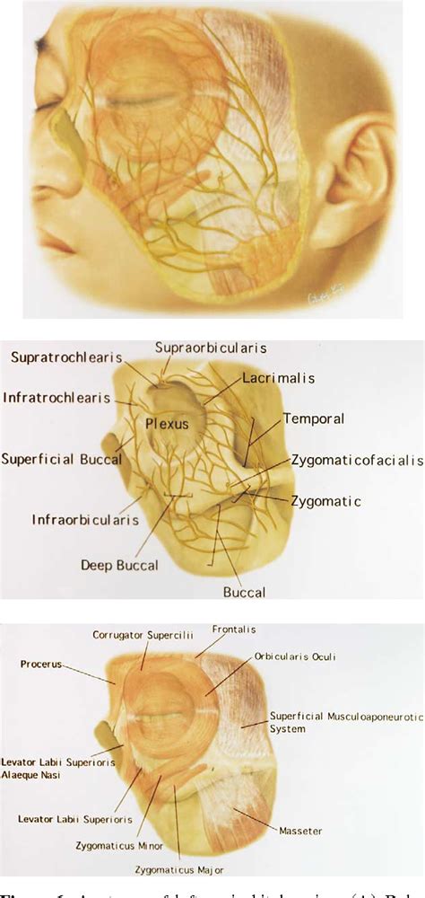 Supraorbital Nerve Origin