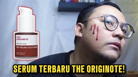 Review Singkat The Originote B Peeling Solution Youtube