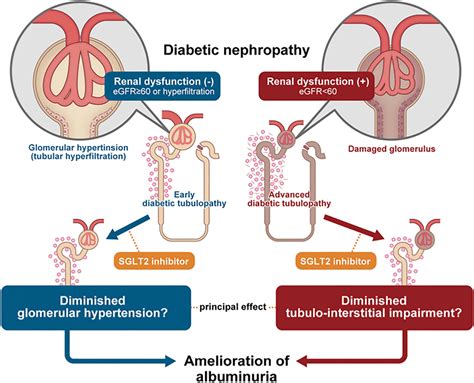 Sglt2 Inhibitors Presentation