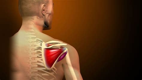 Tratamiento Mediante La Fisioterapia Para La Tendinitis Del Manguito