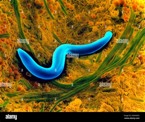 Nematode Worm Coloured Scanning Electron Micrograph Sem Of An