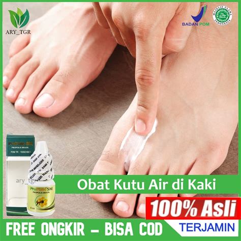 Jual Obat Kutu Air Di Kaki Dan Tangan Ruam Merah Di Kaki Infeksi Jamur