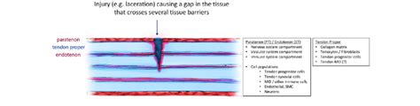 An Acute Injury Crosses From The Intrinsic Tendon Core Into The