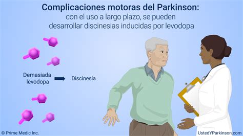 Tratamiento Y Manejo De La Enfermedad De Parkinson