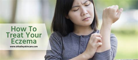How to treat your eczema – Artofit