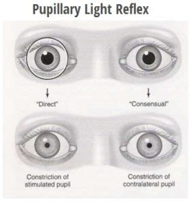 pupillary-light-reflex – Jaya Eye Care Centre is an NABH Accredited Eye ...