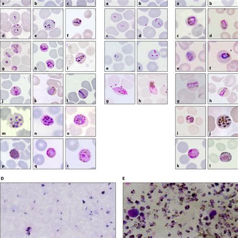 Erythrocytic Stages Of P Knowlesi P Malariae And P Falciparum Download Scientific