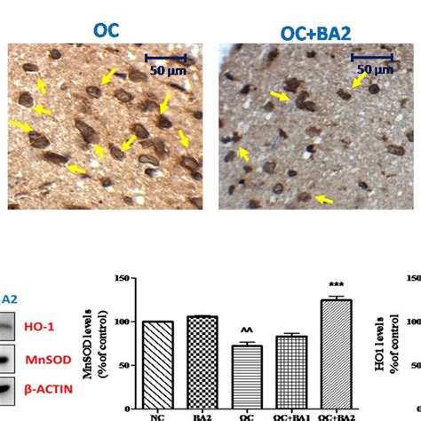 Effect Of Oxaliplatin And Baicalein On Oxidative Stress A Expression