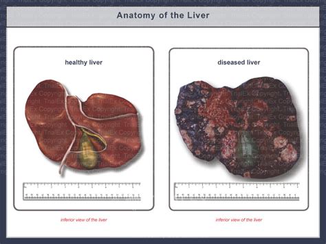 The Anatomy Of A Healthy And Diseased Liver Trial Exhibits Inc