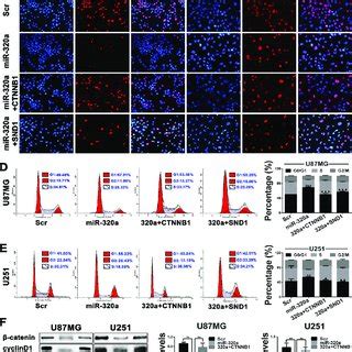 miR 320a suppresses GBM cell proliferation by targeting β catenin and