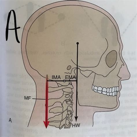 Chapter Musculo Powerpoints Flashcards Quizlet