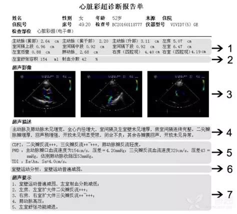 超实用！7 步读懂超声心动图 丁香园