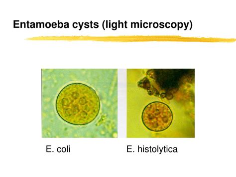 Ppt Protozoa Powerpoint Presentation Free Download Id868153