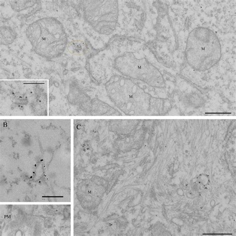 Immunoelectron Microscopic Localization Of Appl Hela Cells Were