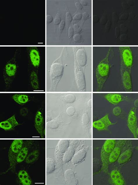 Sumoylation Does Not Affect The Subcellular Localization Of