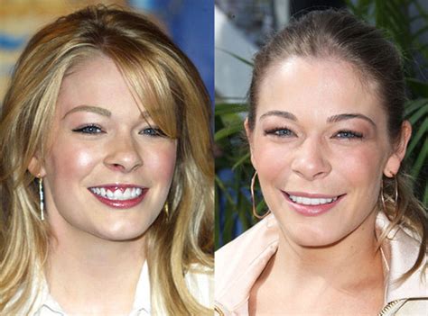 Leann Rimes Plastic Surgery Her Face Appears Shiny And It  Flickr